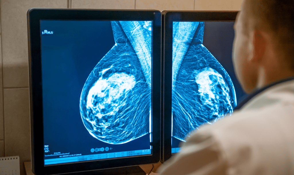 cursos em mamografia